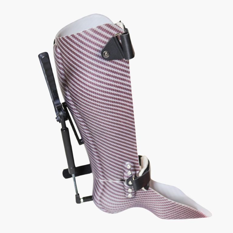 ORLAU Ankle Contracture Correction Device
