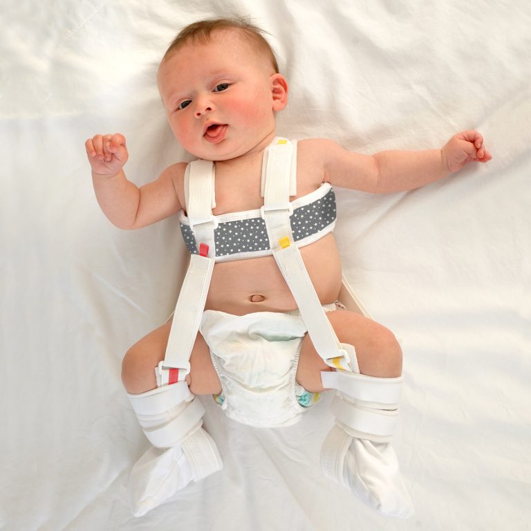 Paediatric Pavlik Harness for babies with Developmental Dysplasia of the Hip (DDH) and hip dysplasia, featuring soft Velfoam straps and colour-coded tabs for accurate fitting.